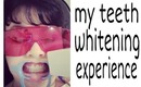 My Teeth Whitening Experience