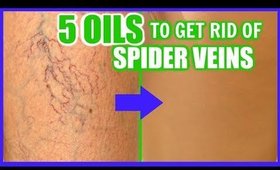 HOW TO GET RID OF SPIDER VEINS WITH ESSENTIAL OILS! │ TOP 5 OILS TO FADE AND ERASE VARICOSE VEINS!