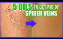 HOW TO GET RID OF SPIDER VEINS WITH ESSENTIAL OILS! │ TOP 5 OILS TO FADE AND ERASE VARICOSE VEINS!