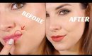 How to Cover Lip Acne | Bailey B.
