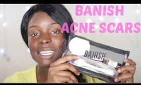 Banish Acne Scars DEMO+REVIEW