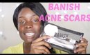 Banish Acne Scars DEMO+REVIEW