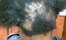 Relaxer gone Wrong!!!!!!!!!!!!