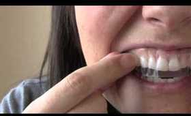 How to get Whiter teeth in 2 hours!
