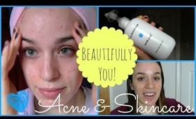 My Skin Resolution + My Battle With Acne | Beautifully You Ep. 01