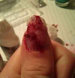 broken nail.. 