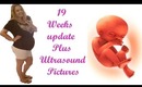 19 weeks Pregnancy  update