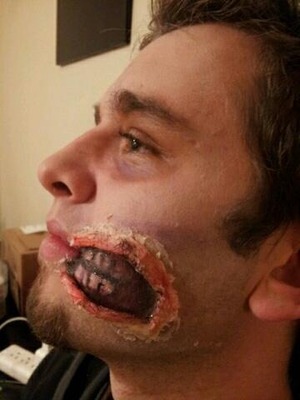 My first attempt at a half mouth open gash. Made with Elmer's glue, toilet paper, and Halloween makeup.