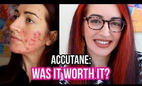 My FINAL Accutane Update (I hope...) Results: What's Good & What's BAD!
