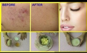 Get rid of dark spots,Acne spots & scars -Get fairer & bright skin in 7 days-100% guranteed
