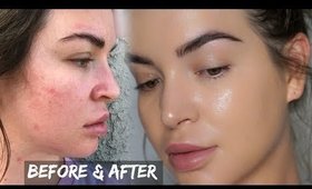 Skin Care Hack for ALL SKIN TYPES!