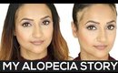 My Alopecia Story