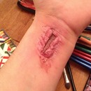 Wrist scar