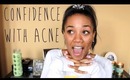 How To Be Confident With Acne ♡