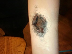 My VERY first try at Special FX make-up for Halloween on my arm(:
I was pleased with the outcome!