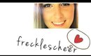 ❤ Frecklescheer ❤
