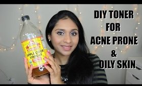 DIY Toner for Acne Prone & Oily Skin| Home Remedies For Acne