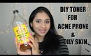 DIY Toner for Acne Prone & Oily Skin| Home Remedies For Acne