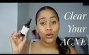 Skincare Series- Part III: Overnight Acne- Clearing Routine