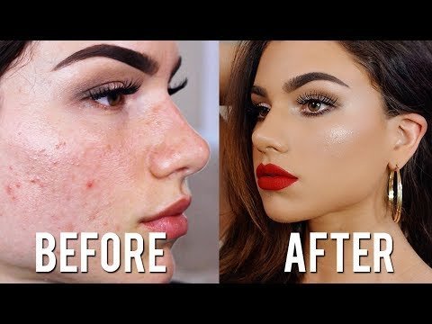 how to cover up scars with makeup