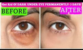 How To Get Rid Of Dark Circles In 3 Days Permanently | SuperPrincessjo