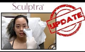 SCULPTRA UPDATE | SEREIN WU