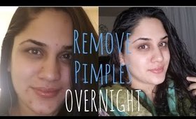 How To REMOVE ACNE Overnight | 4 Quick Remedies that really work!