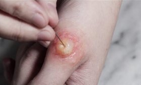 How to Make a ( Poppable) Blister