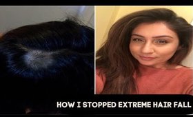 How I stopped hair fall thinning hair and grew new hair thick hair