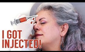 DYSPORT OR BOTOX?! My Experience