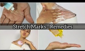 Stretch Marks : How to get Rid of #StretchMarks -  Tips & Home Remedies | SuperWowStyle DIY