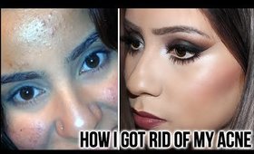 HOW TO GET RID OF ACNE : MY STORY - SKIN CARE ROUTINE