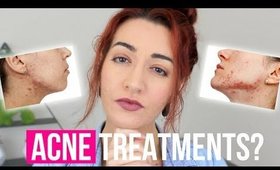 ACNE TREATMENTS - WHAT WORKED & WHAT SUCKED! Commenting On your Comments! | Jess Bunty