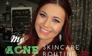 My Acne Skincare Routine