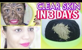 How To Get Clear Skin in 3 Days | SuperPrincessjo