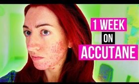 1 WEEK DOWN! MY ACCUTANE/ACNE UPDATE + MENTAL HEALTH CHAT! Jess Bunty Acne Vlog 2
