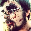 Zombie Reid lost an eye D: