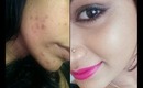 Easy & Quick Foundation Routine - Covering Acne Scars.