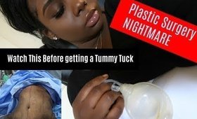 ( ReUpload ) I almost died 😞 My Plastic Surgery Story!!!