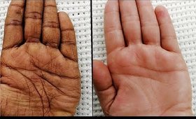 How to Get Soft Wrinkle Free Hands? _ Homemade Recipe For Dry Rough Hands & Feet