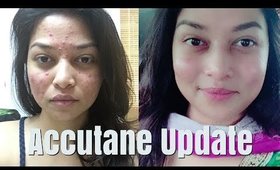 Accutane Journey: Im on high dose now!