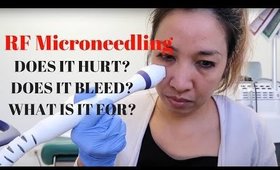 HOW TO RADIOFREQUENCY MICRONEEDLING