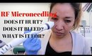 HOW TO RADIOFREQUENCY MICRONEEDLING