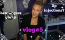 VLOG#5-LIP INJECTIONS?- RANTING-GURU GOSSIP-FAMILY TIME