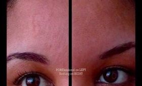 Benefit The POREfessional | Minimize Large Pores: A Demonstration with Dramatic Results