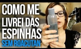 Como eu me livrei das espinhas / acne em três meses com produtos baratos (sem Roacutan)
