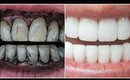 How To Whiten Teeth Instantly at Home with Charcoal! │Get White Teeth Naturally in 3 Minutes!!