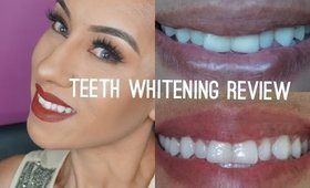 TEETH WHITENING REVIEW