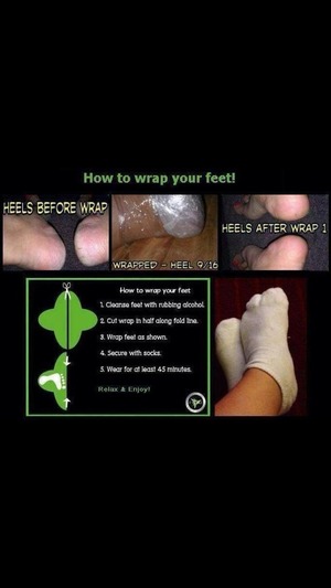 Are your feet flip flop ready?? Check out my products that will help. All natural!! 
www.daniellemeek.myitworks.com
Facebook: It Works Arkansas Skinny Girlz