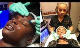 My Hydrafacial Experience | #AmorYourself